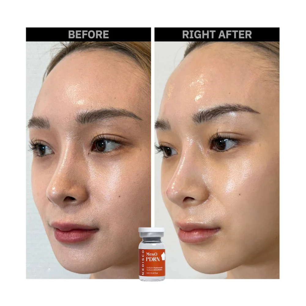 Medisco MesO PDRN – Advanced Skin Regeneration Ampoule - Image 7