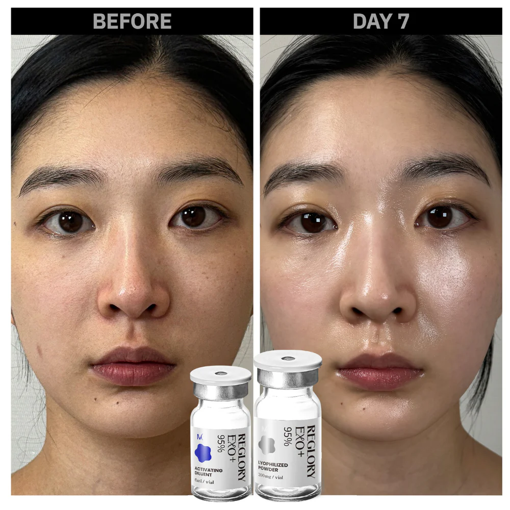Reglory EXO Exosome Skin Booster - Image 7