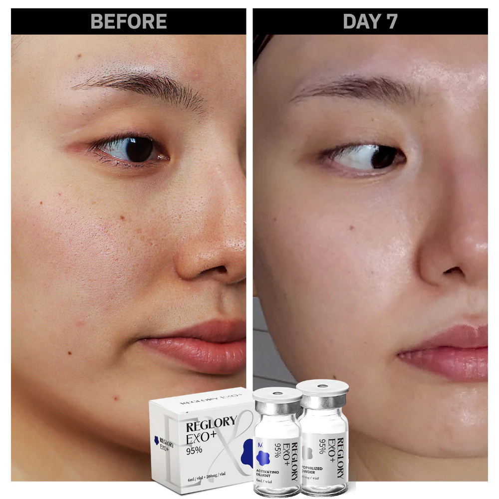 Reglory EXO Exosome Skin Booster - Image 8