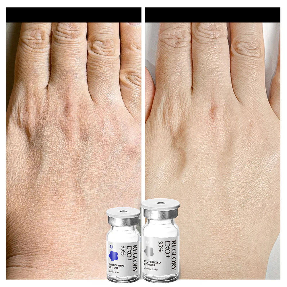 Reglory EXO Exosome Skin Booster - Image 9
