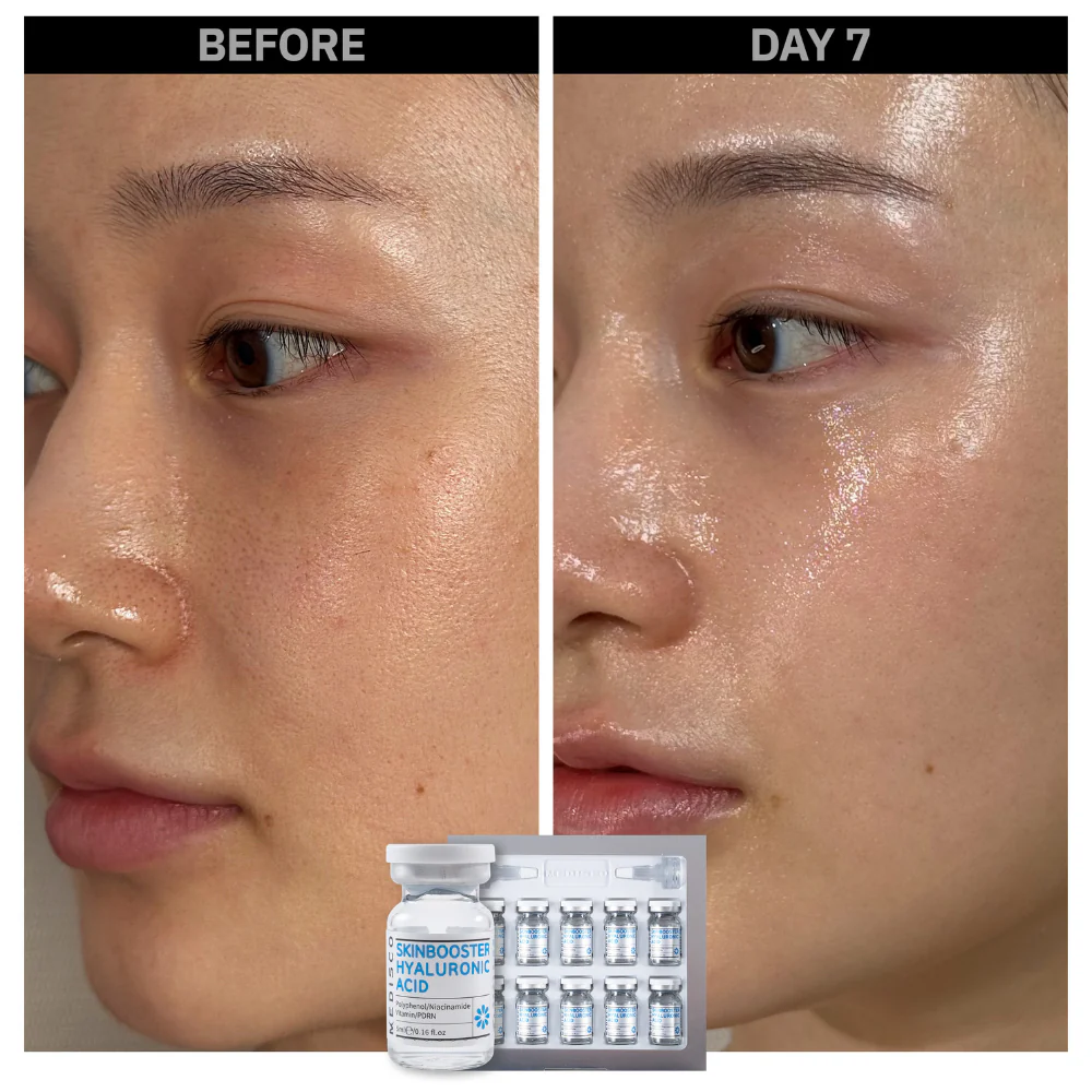Stayve Booster Starter Kit 2 (Microneedling Ampoule) - Image 6