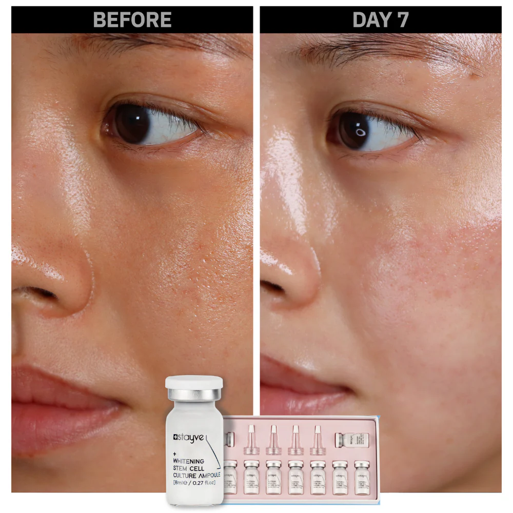 Stayve Booster Starter Kit (Microneedling Ampoule) - Image 11