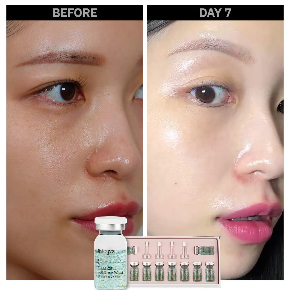 Stayve Booster Starter Kit (Microneedling Ampoule) - Image 9